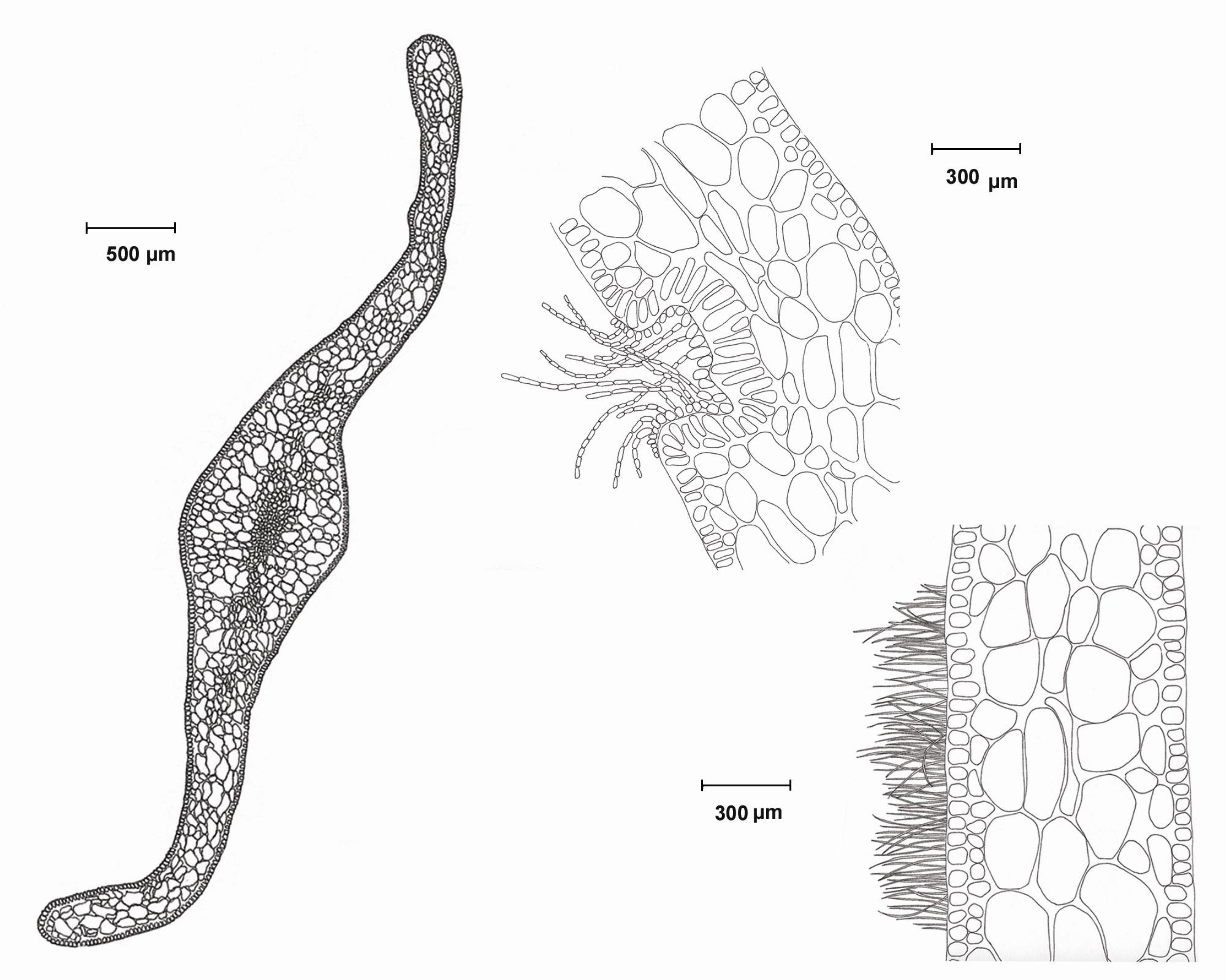 figura 18. Sargassum. Sección transversal de un filidio u hoja mostrando arreglo de médula y corteza (izquierda) y detalle de pelos feofíceos en cavidades (arriba centro) o superficiales (abajo derecha).