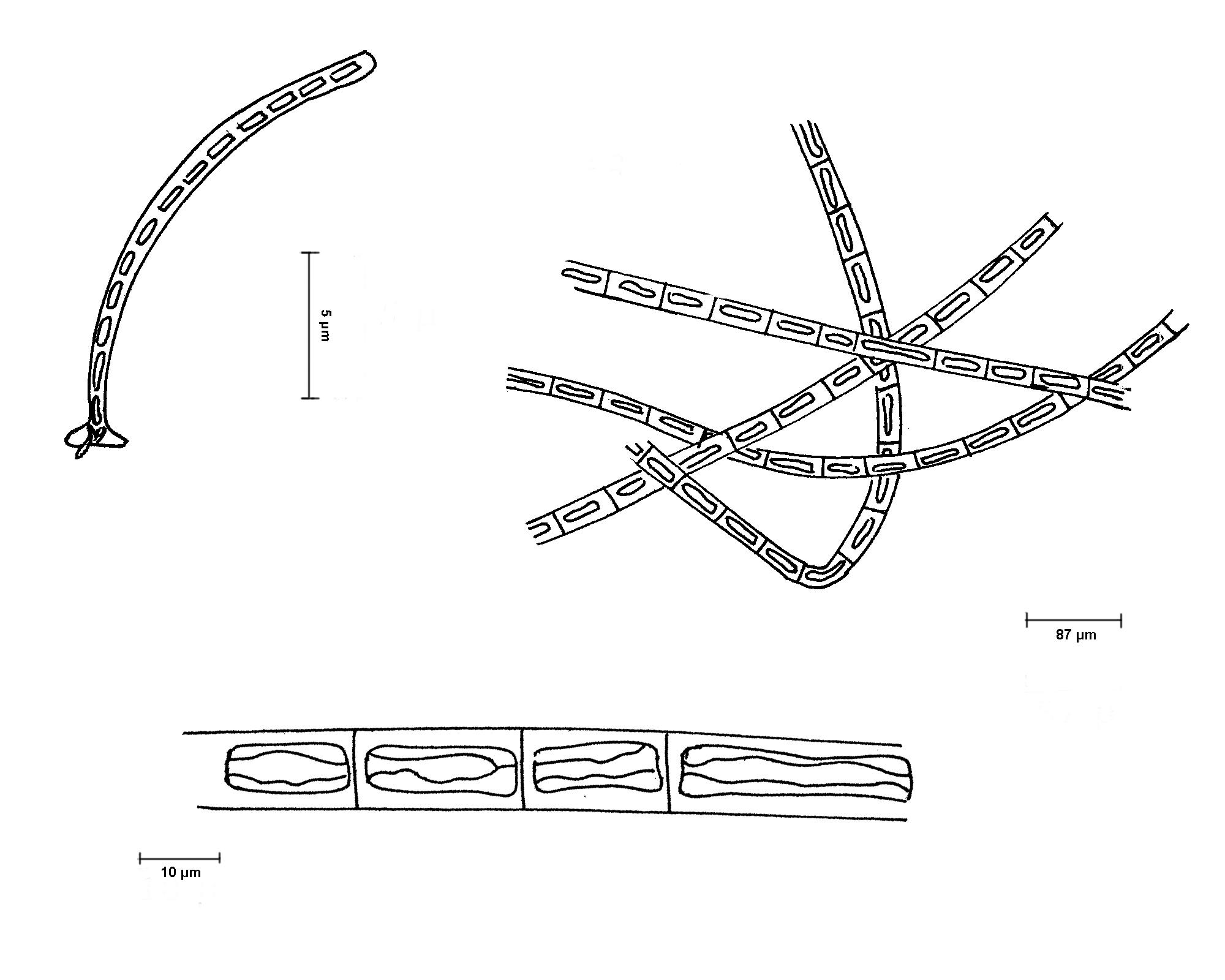 fig. 55. Ulothrix.Hábito (arriba izquierda), crecimiento (arriba derecha) y detalle de los septos del filamento.

